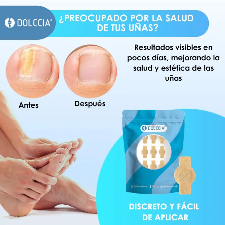 PARCHES ANTIHONGOS DOLCCIA® - PROMO + ENVÍO GRATIS
