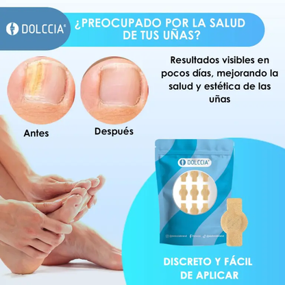 PARCHES ANTIHONGOS DOLCCIA® - PROMO + ENVÍO GRATIS
